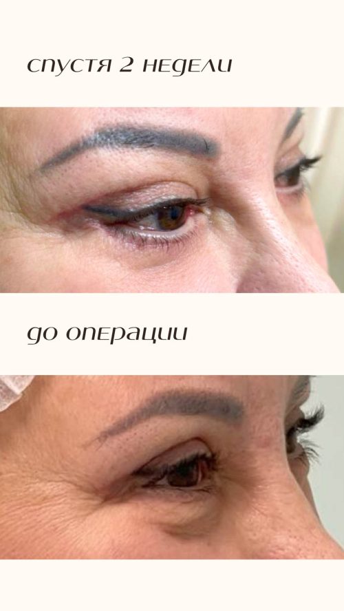 Пластика лица